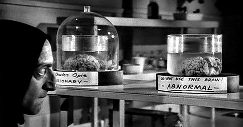 Abnormal brain